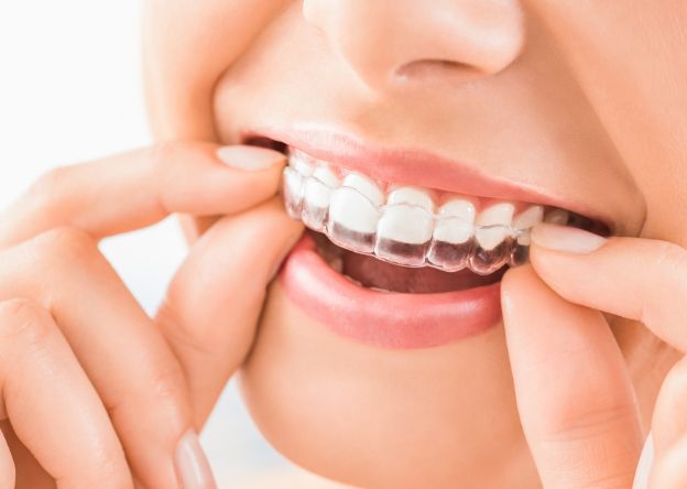 Invisible Aligners-What are they and How they Work?