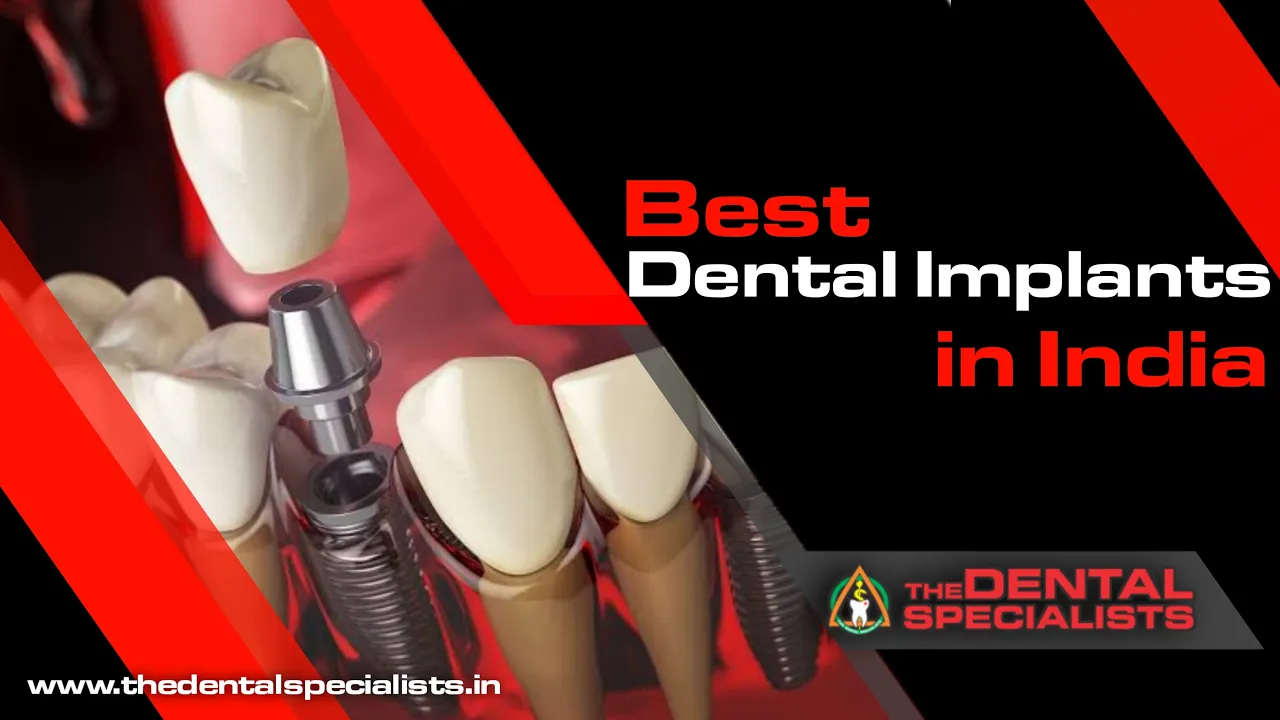 Best Dental Implants in India